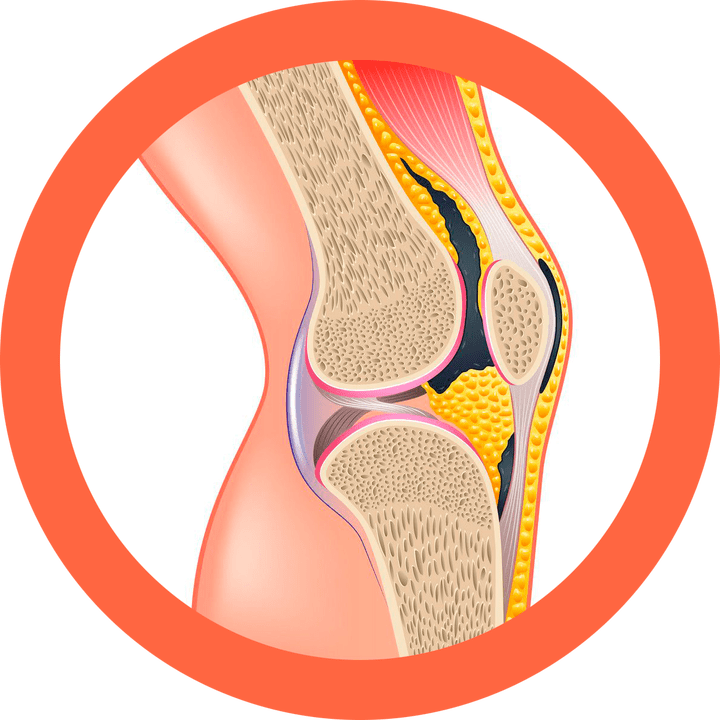 Hondrotene – ripristina articolazioni e muscoli