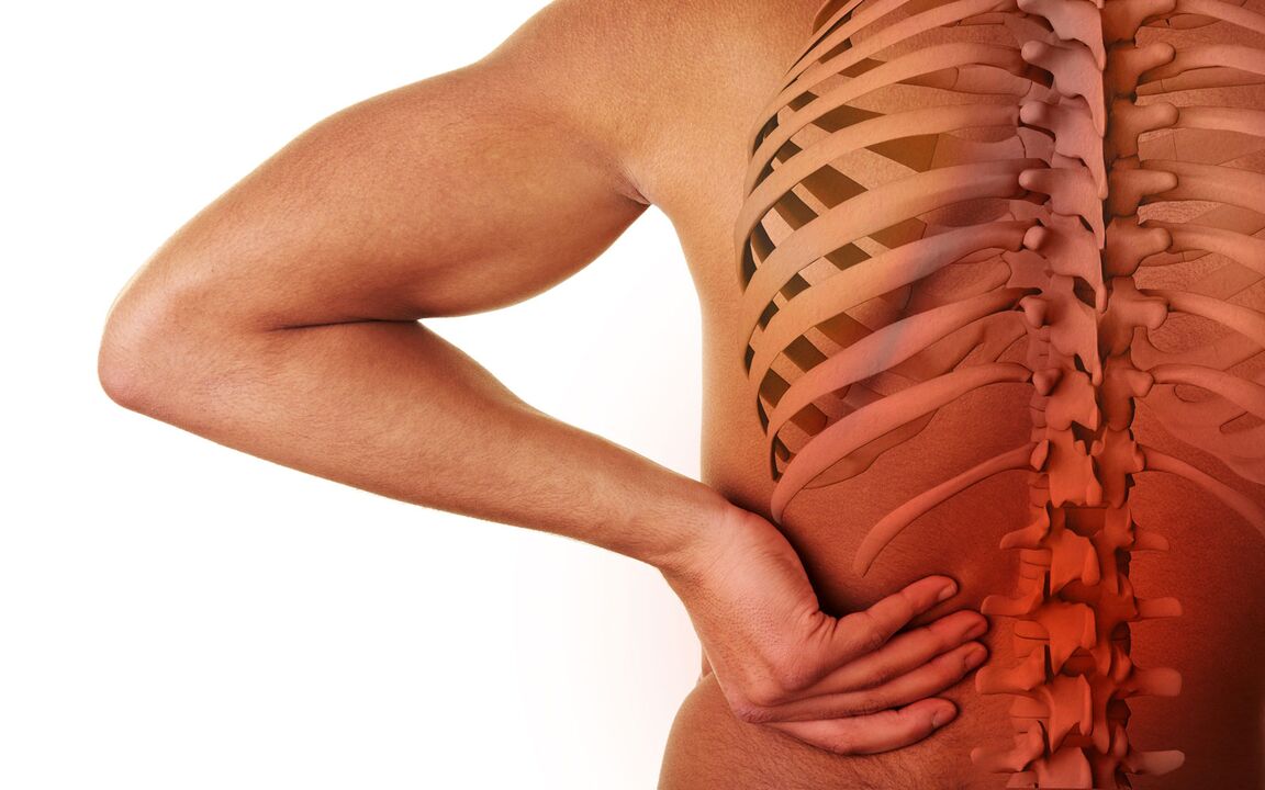 Sintomi dell'osteocondrosi lombare