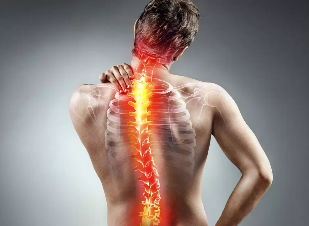 Osteocondrosi della colonna vertebrale